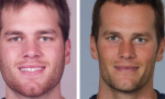 Tom Brady plastic surgery rumors.